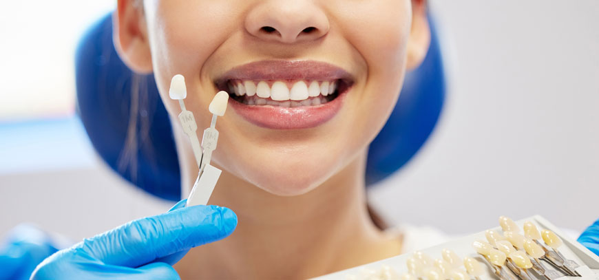 Λεύκανση Δοντιών