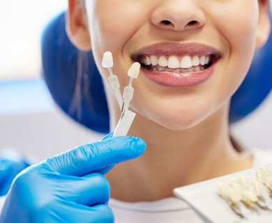 Λεύκανση Δοντιών για φυσικό αποτέλεσμα