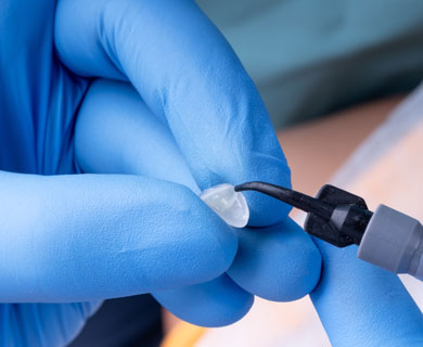 Όψεις Ρητίνης