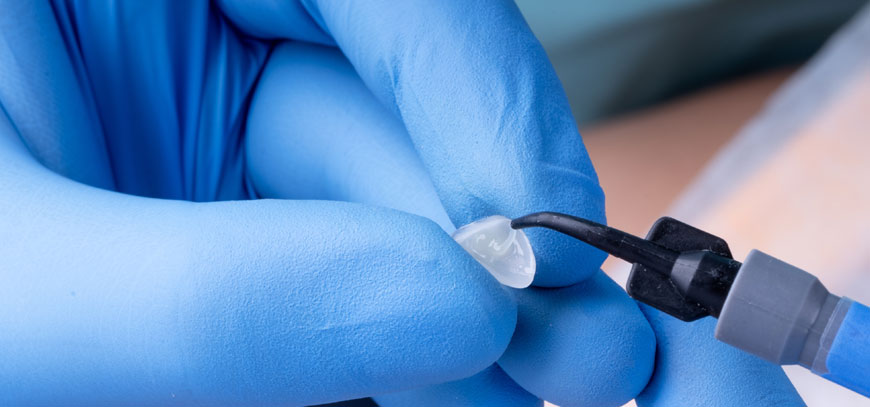 Όψεις Ρητίνης & Πορσελάνης