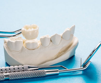 Προσθετική Δοντιών